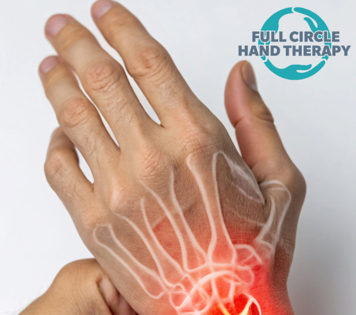 Image for Hand Arthritis Workshop