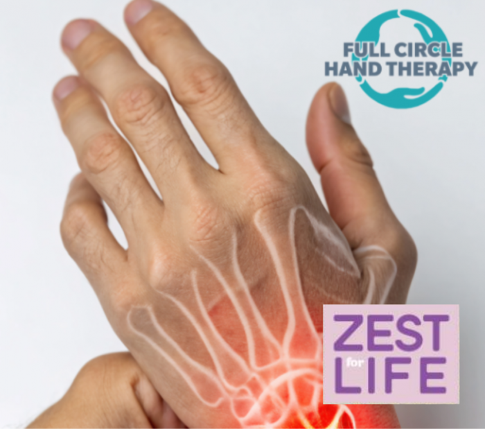 Image for Hand Arthritis - Zest for Life